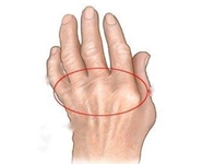 Artrit Hastalığı Belirtileri ve Tedavisi Artrit Hastalığı Belirtileri ve Tedavisi