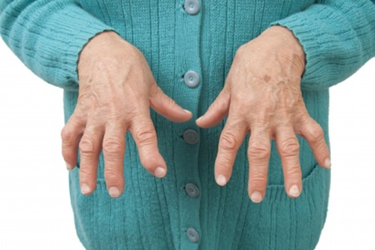 nflamatuar Artritler